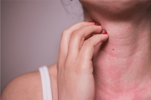 Clove Oil and Cancer: Separating Fear from Facts 9 Itching skin on neck due to allergy
